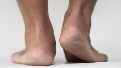 5-Ways-to-care-for-Your-Feet