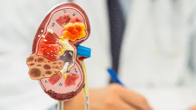 Three dimensional color model of a kidney