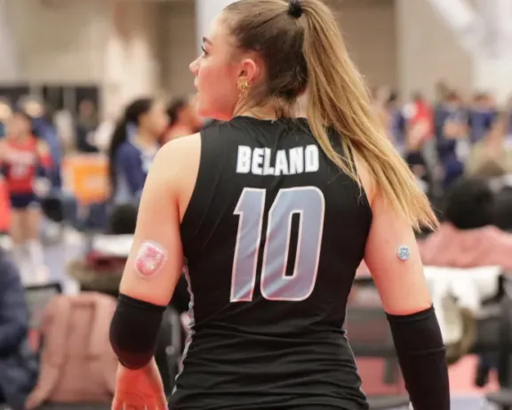 Volleyball player in black jersey, number 10, with diabetes devices on both arms.