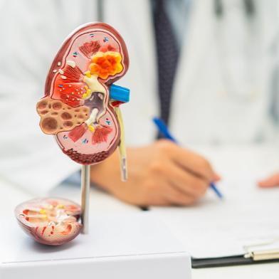 Three dimensional color model of a kidney