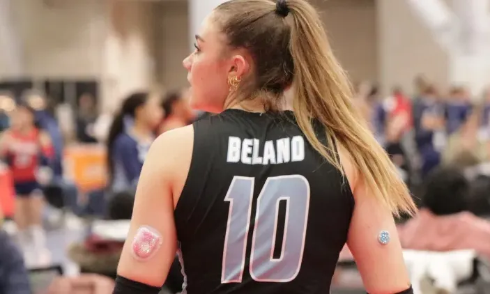 Volleyball player in black jersey, number 10, with diabetes devices on both arms.